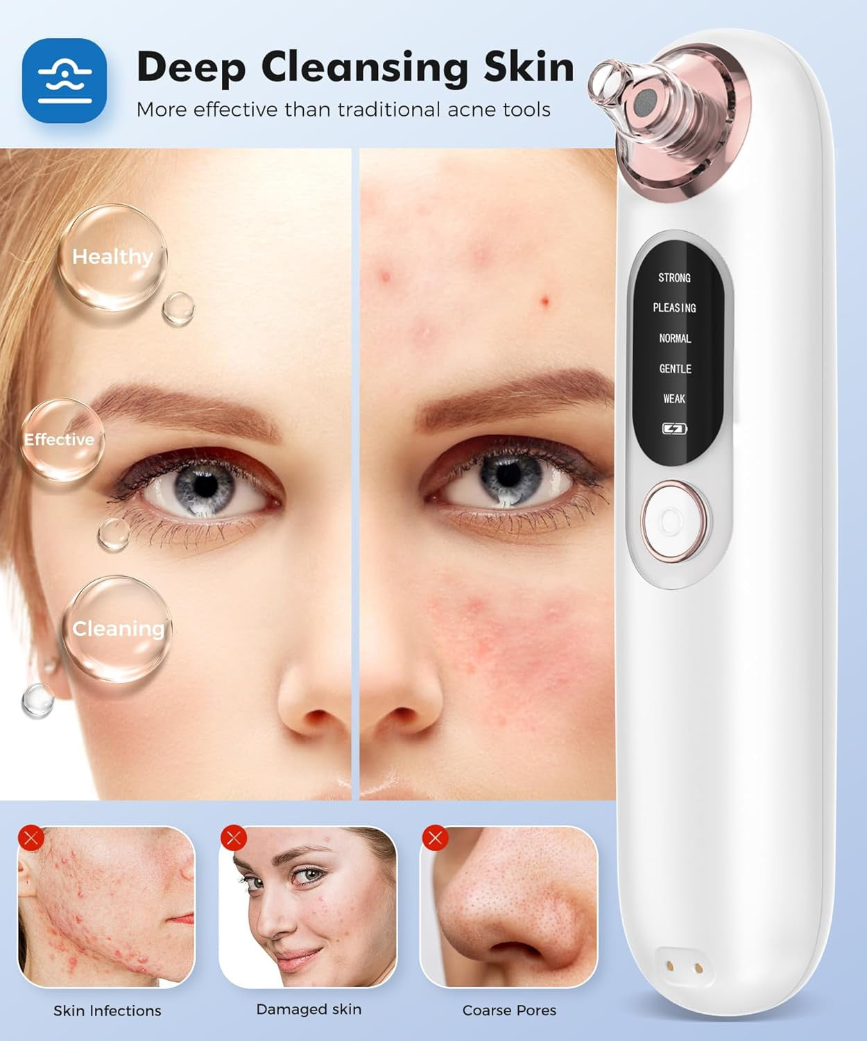 5-Speed Blackhead Remover for Sensitive Skin, Wireless Charging Face Pore Clea