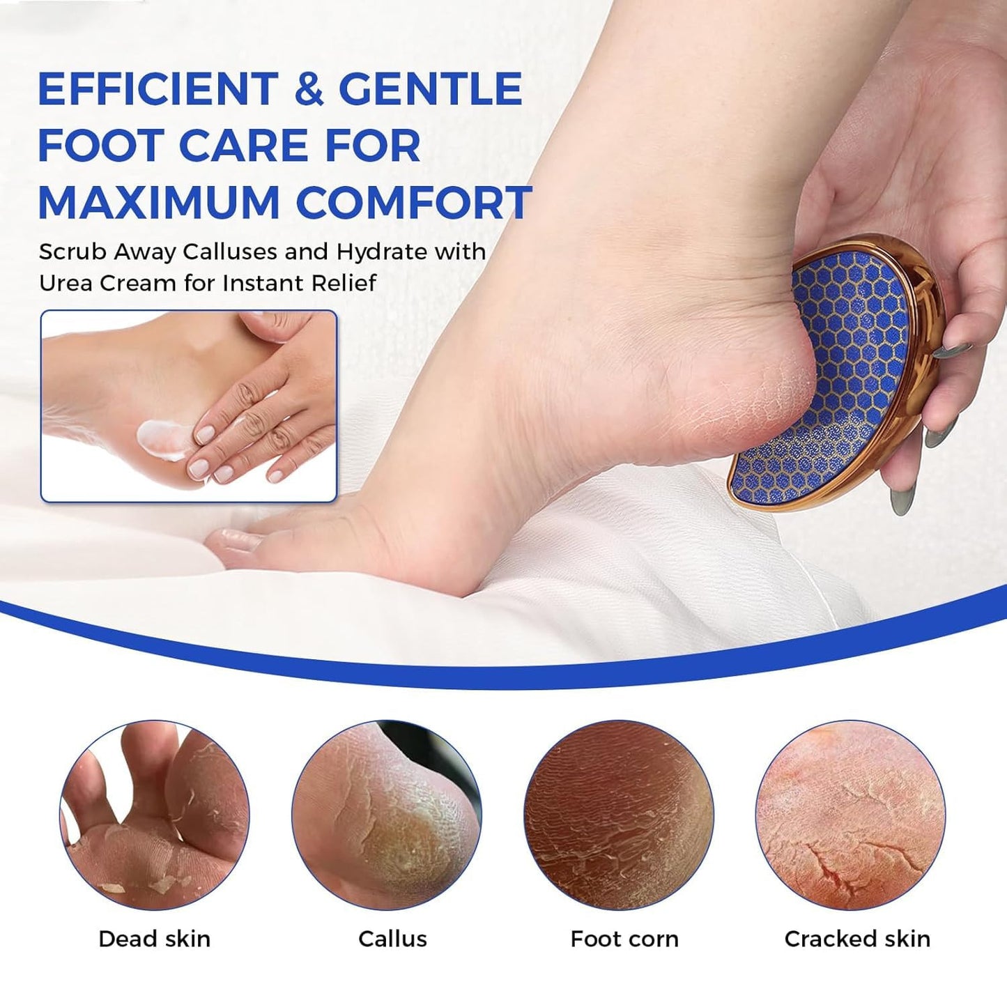 Urea Cream 40 Percent for Foot & Hand Cream with Foot Files for Dry Cracked,Urea