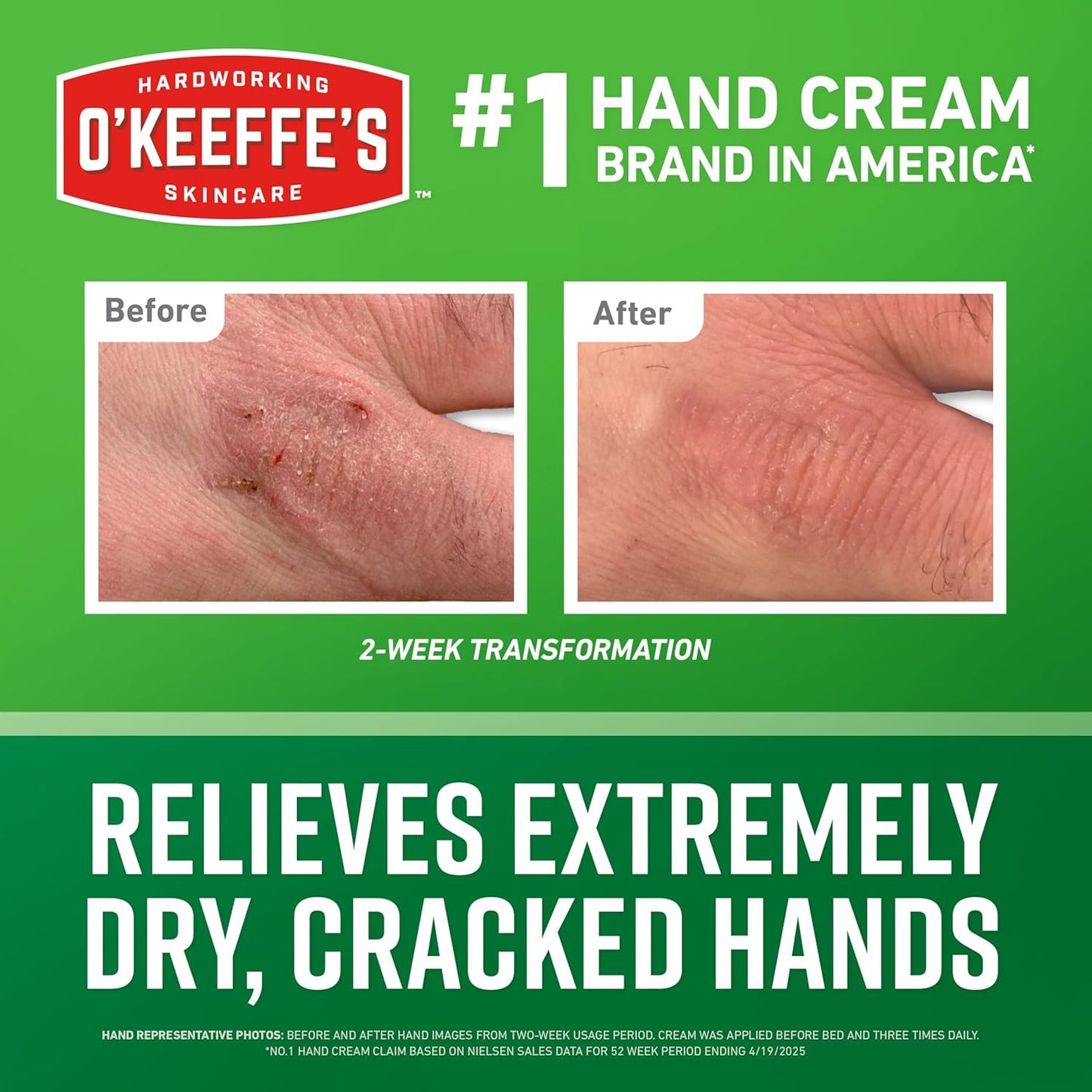 Working Hands Hand Cream in a Pumpable Jar for Extreme Dryness – 10Oz Pump (1 Pa