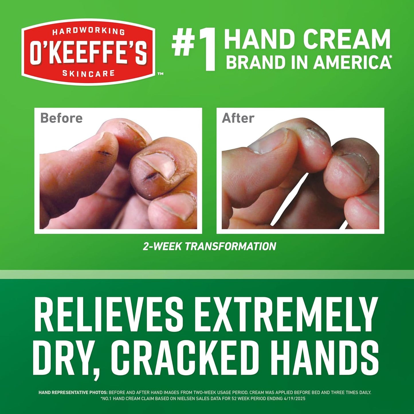 Working Hands Hand Cream for Extreme Dryness - 3.4 Oz Jar (1 Pack) - Repairing S