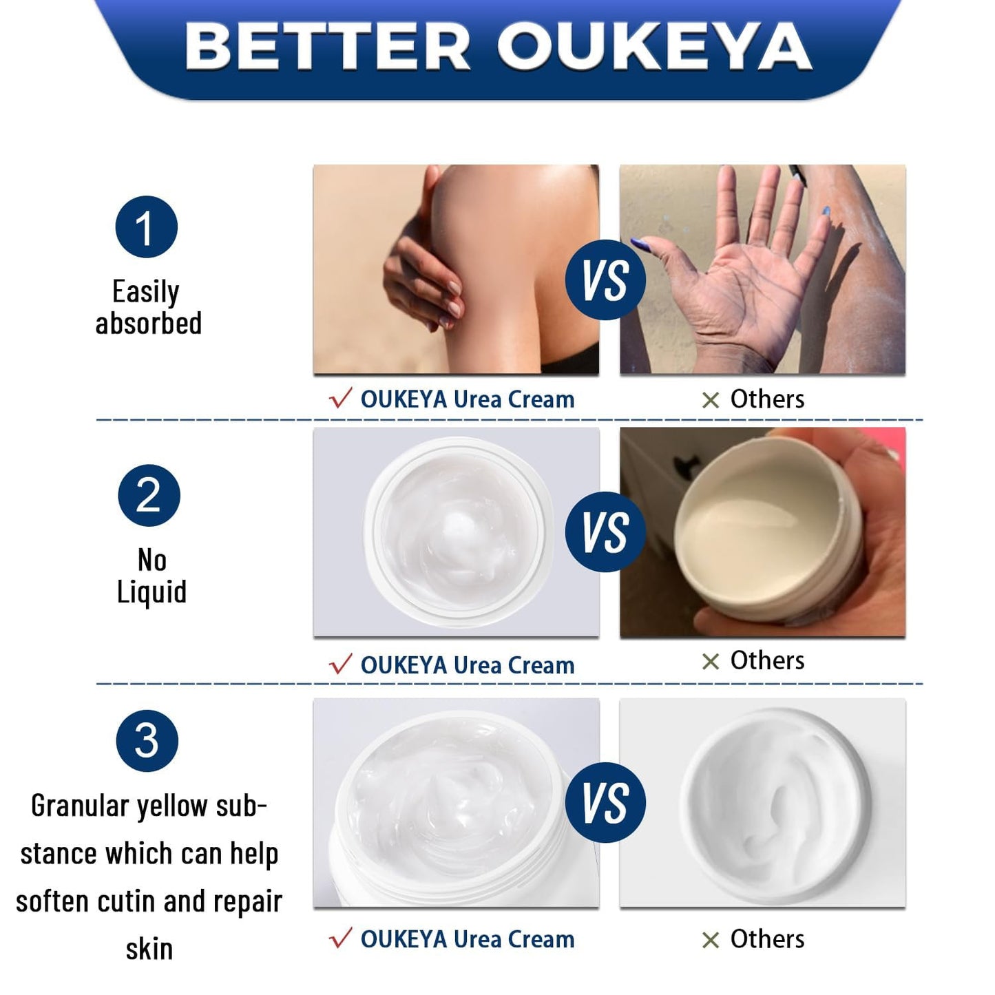 Urea Cream 40 Percent, Foot & Hand Cream for Dry Cracked, Urea Lotion for Feet M