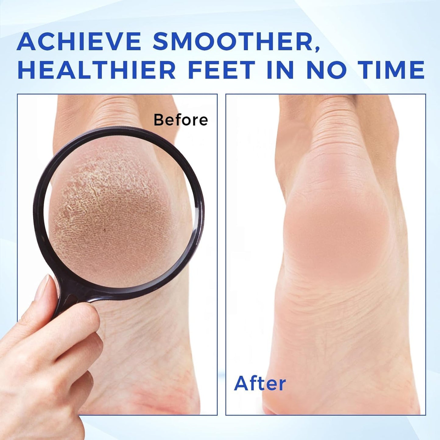 Urea Cream 40 Percent for Foot & Hand Cream with Foot Files for Dry Cracked,Urea