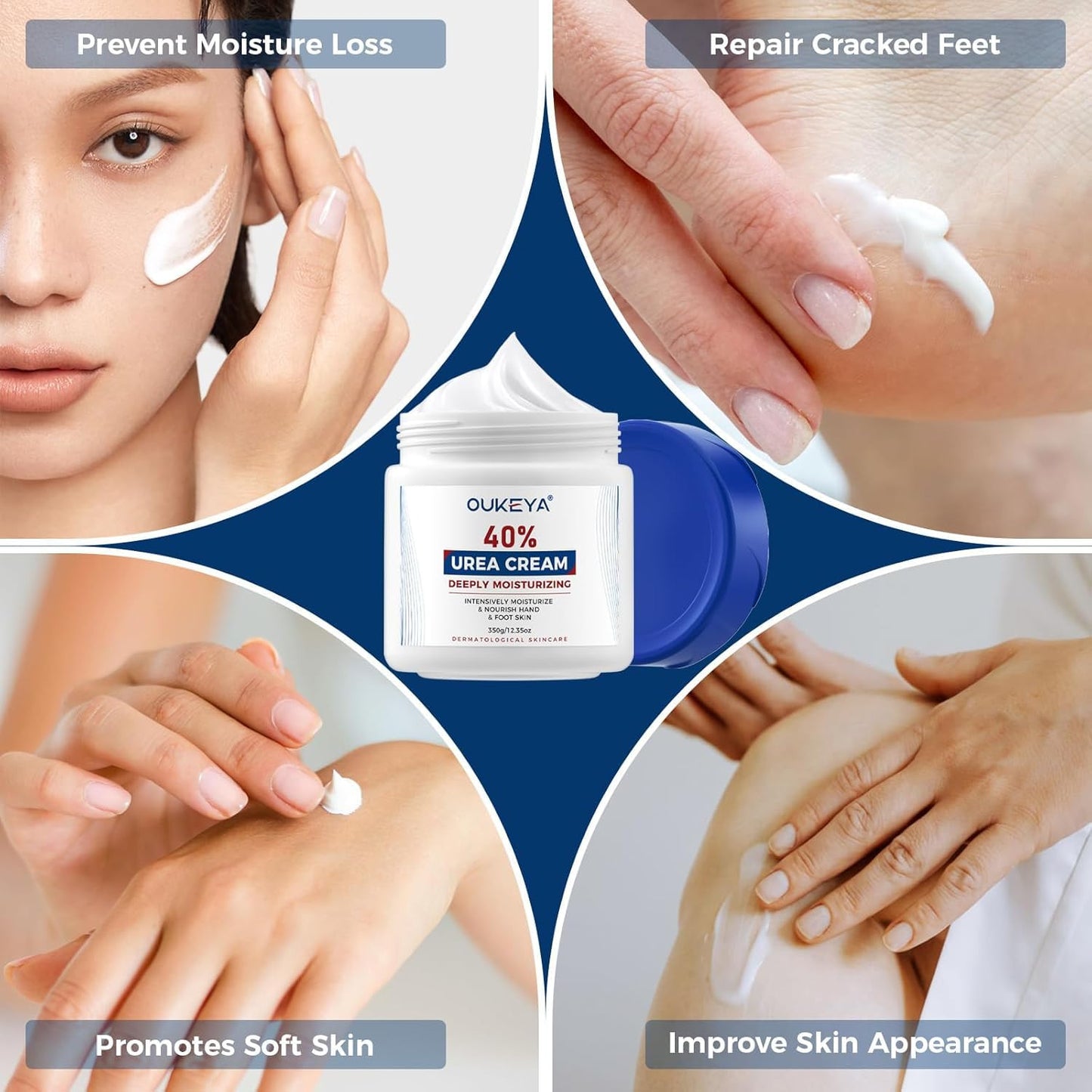 Urea Cream 40 Percent, Foot & Hand Cream for Dry Cracked, Urea Lotion for Feet M
