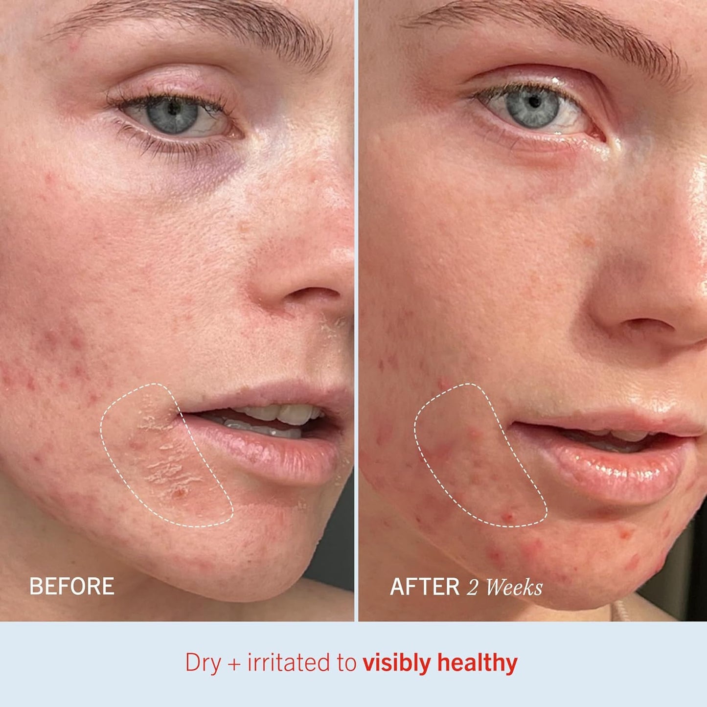 - Ultra Repair Cream, Intense Hydration Whipped Colloidal Oatmeal, Clinically Pr
