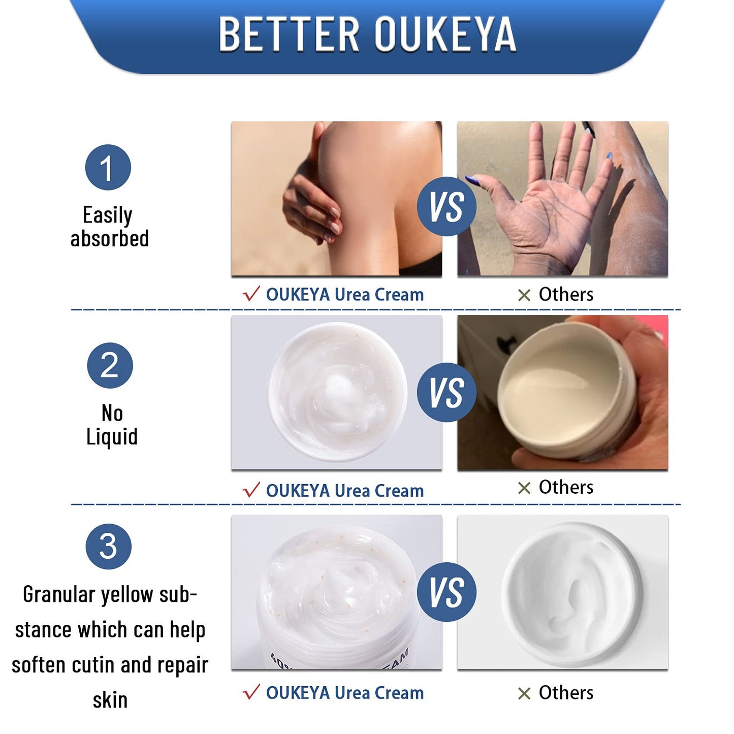 Urea Cream 40 Percent,Foot & Hand Cream for Dry Cracked,Urea Lotion for Feet Max