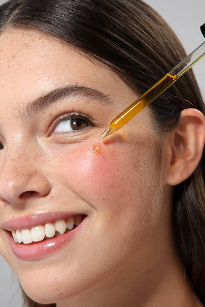 Organic Rosehip Seed Oil for Face, 100% Pure | Natural Cold Pressed Unrefined No