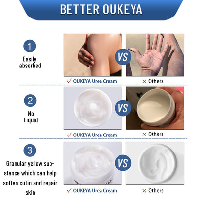 Urea Cream 40 Percent,Foot & Hand Cream for Dry Cracked,Urea Lotion for Feet Max