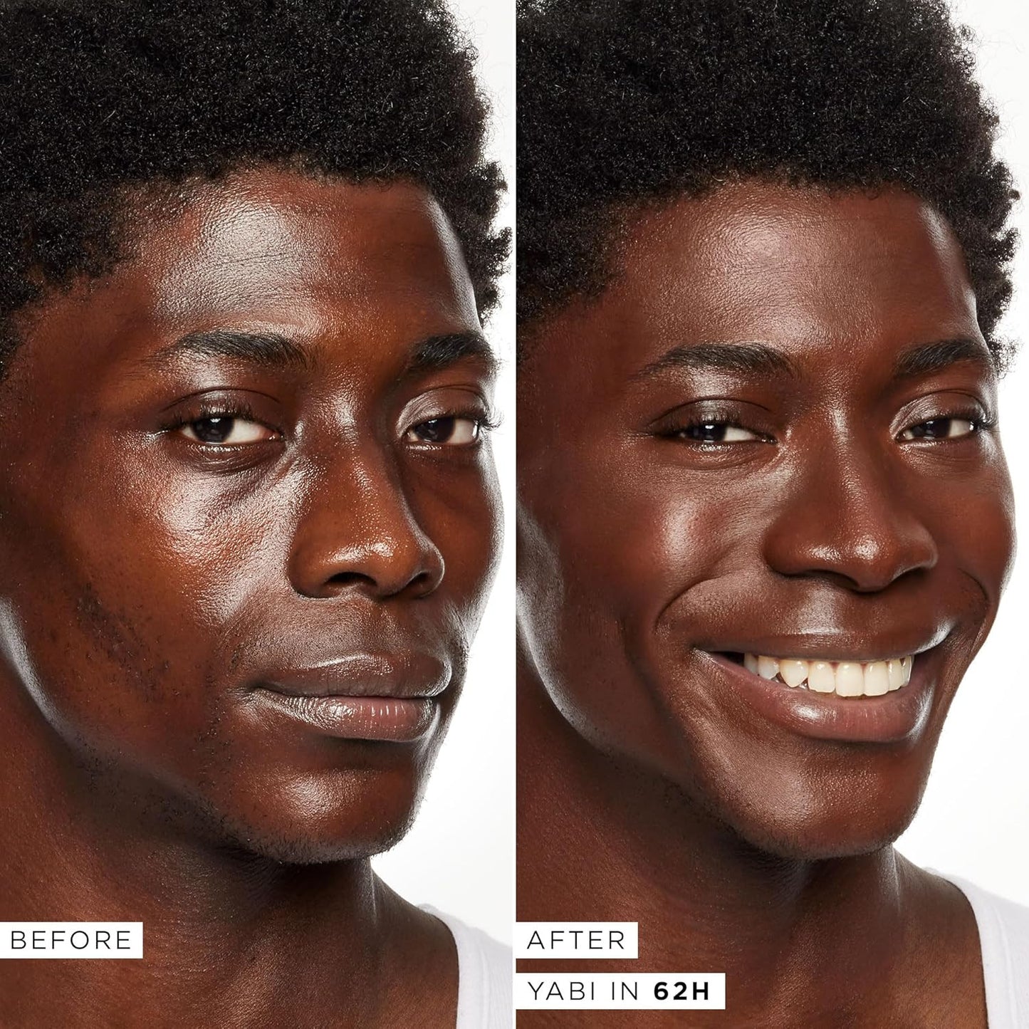 Tarte Shape Tape Full-Coverage Concealer