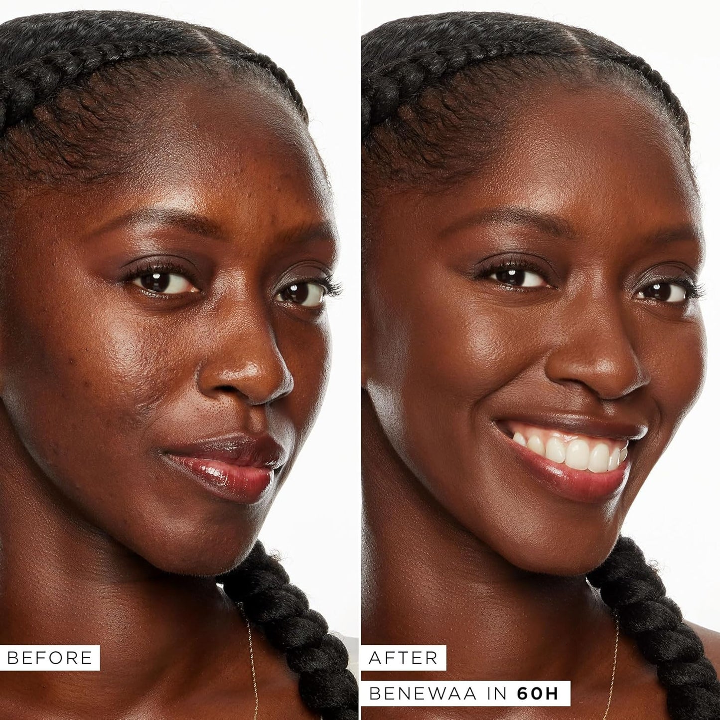 Tarte Shape Tape Full-Coverage Concealer