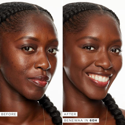 Tarte Shape Tape Full-Coverage Concealer