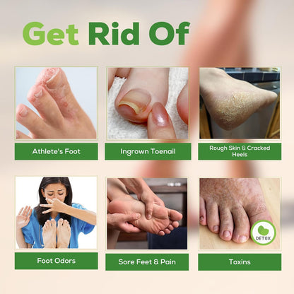 Tea Tree Oil Foot Soak with Epsom Salt - Best Toenail Fungus Treatment, Athletes