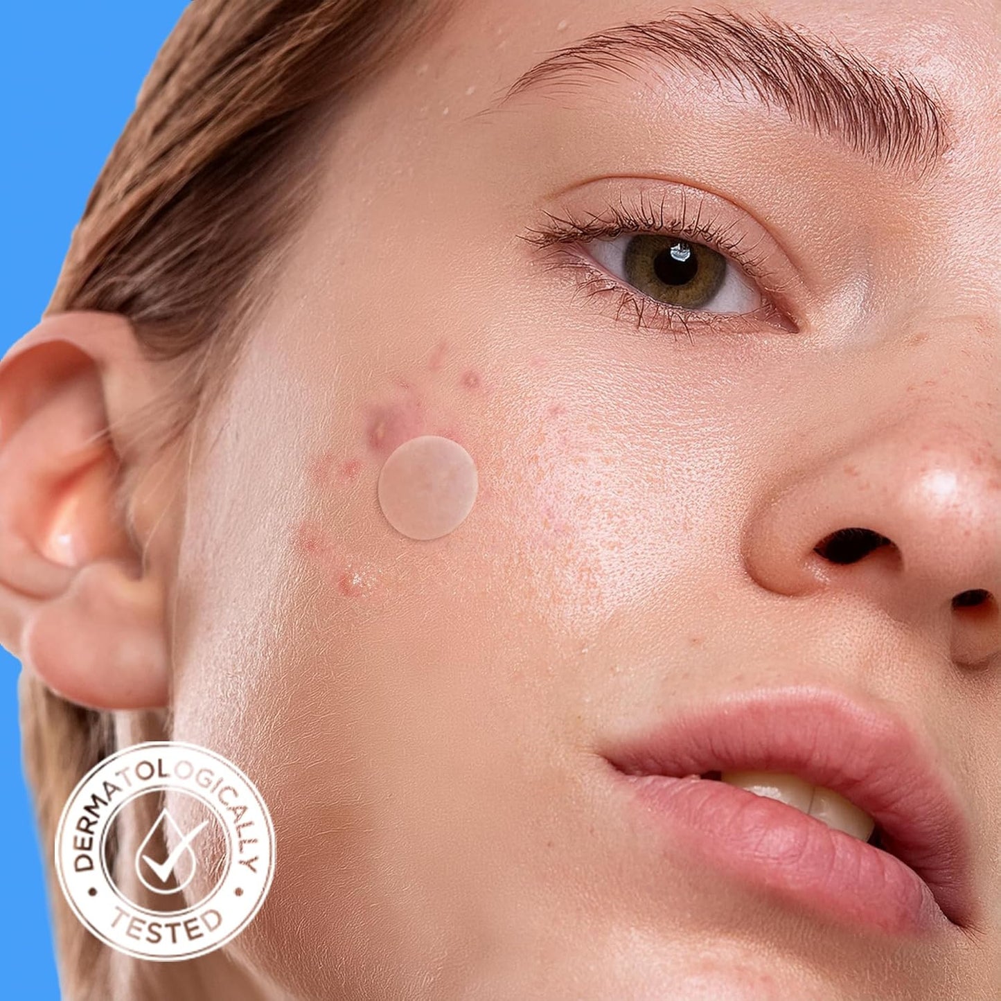 Acne Cover Patch Original Hydrocolloid, Tea Tree, Calendula Oil, CICA. Certified